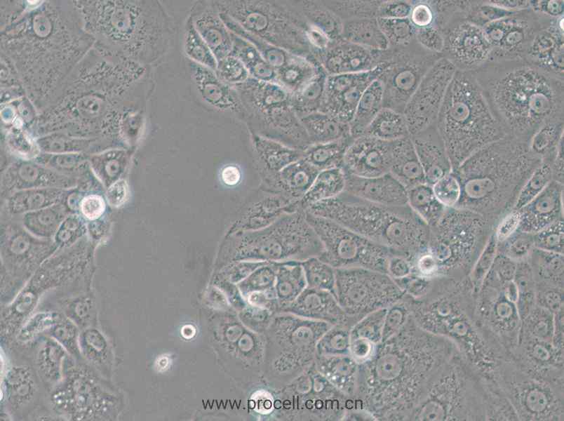 ACT-1 (人甲状腺癌细胞) (STR鉴定正确)
