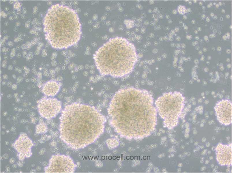 MT-4 (人T细胞白血病细胞) (STR鉴定正确)（仅提供冻存管）