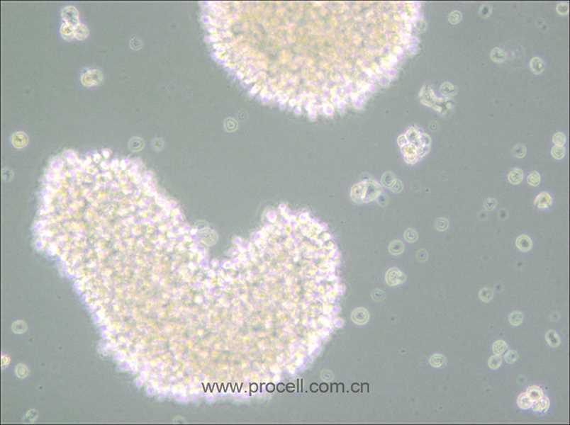 MT-4 (人T细胞白血病细胞) (STR鉴定正确)（仅提供冻存管）