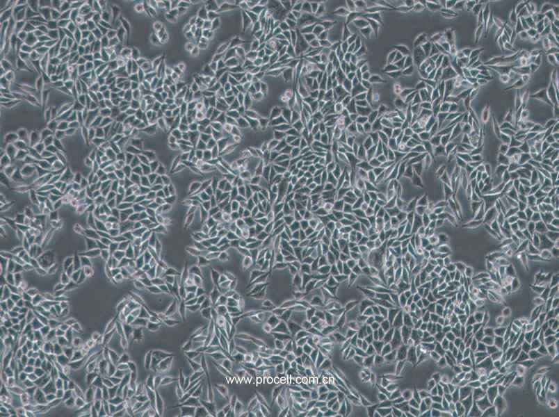 L-WRN (小鼠皮下结缔组织细胞) (新引进) (种属鉴定正确)