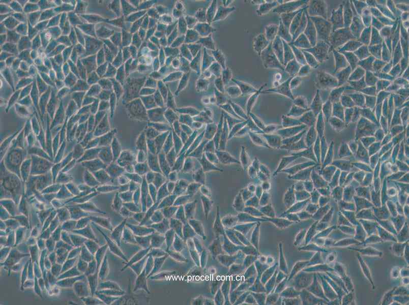 L-WRN (小鼠皮下结缔组织细胞) (新引进) (种属鉴定正确)