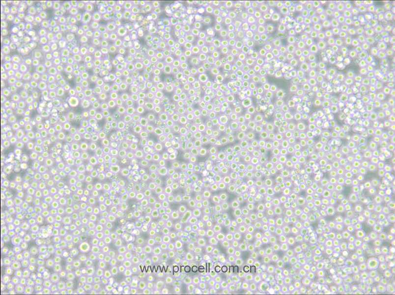 MEL (小鼠红白血病细胞) (STR鉴定正确)