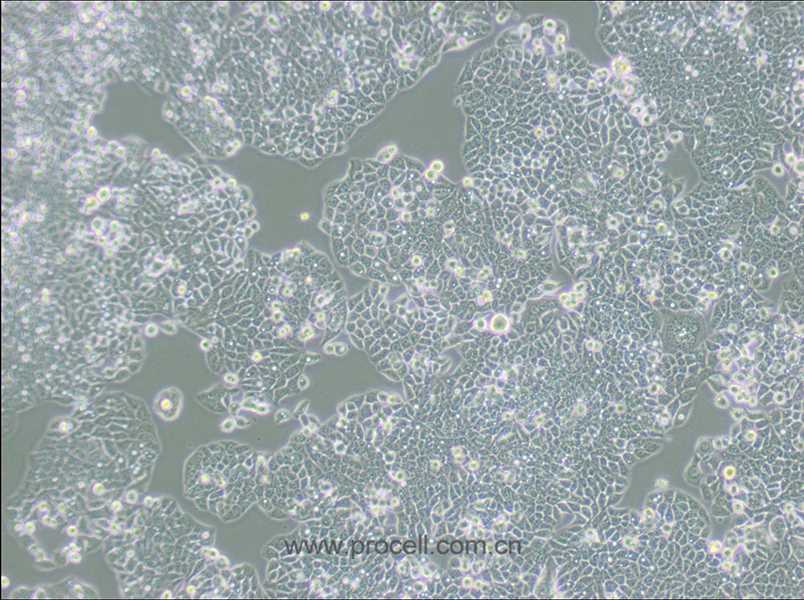 CX-1（人结肠癌细胞）(STR鉴定正确)