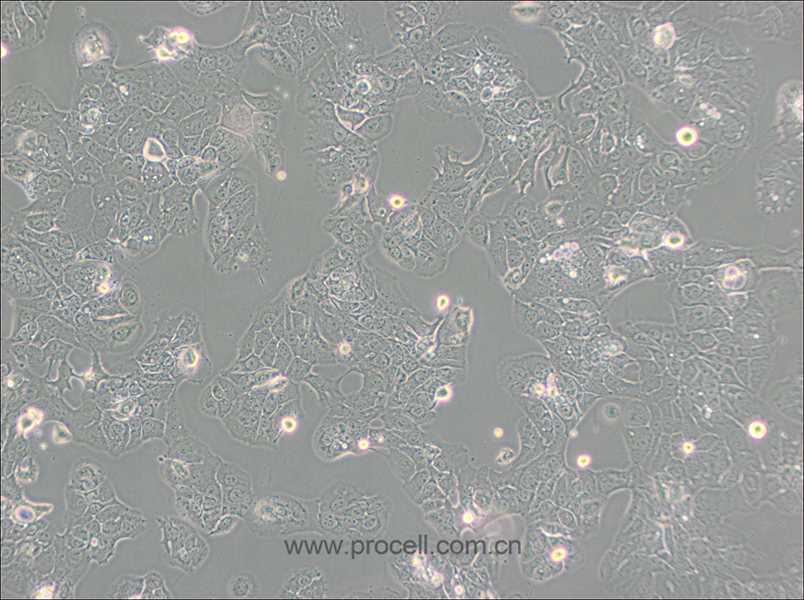 HT-1376(人膀胱癌细胞)（STR鉴定正确）