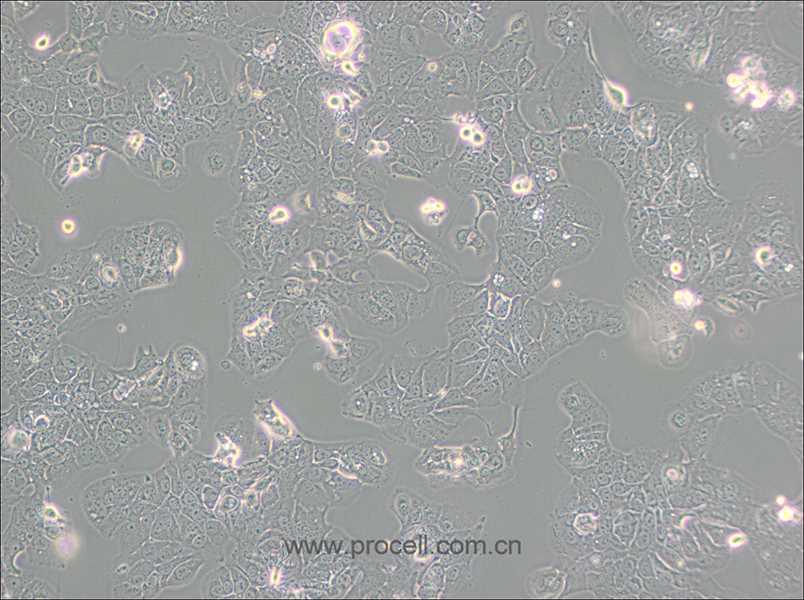 HT-1376 (人膀胱癌细胞) (STR鉴定正确)