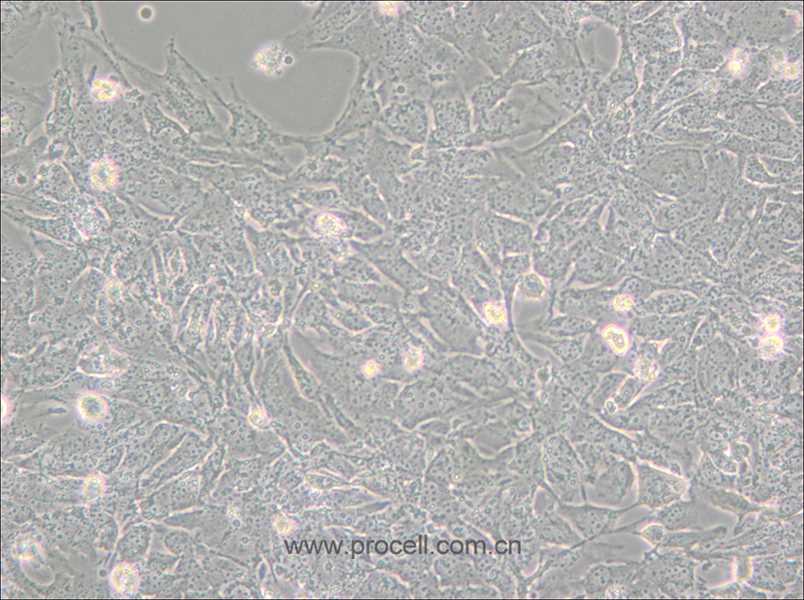 TTA1 (人甲状腺癌细胞) (STR鉴定正确)