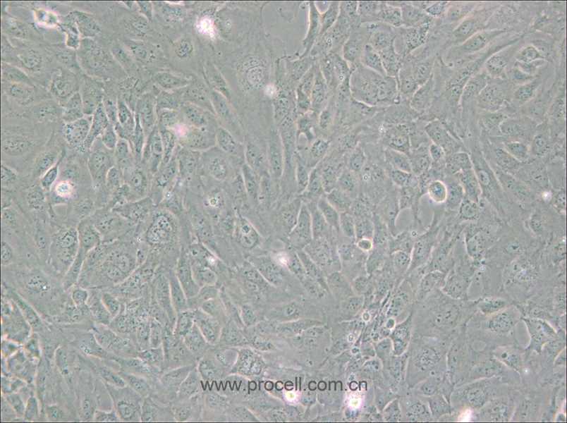 PUMC-HUVEC-T1 (SV40T转化人脐静脉内皮细胞) (STR鉴定正确)