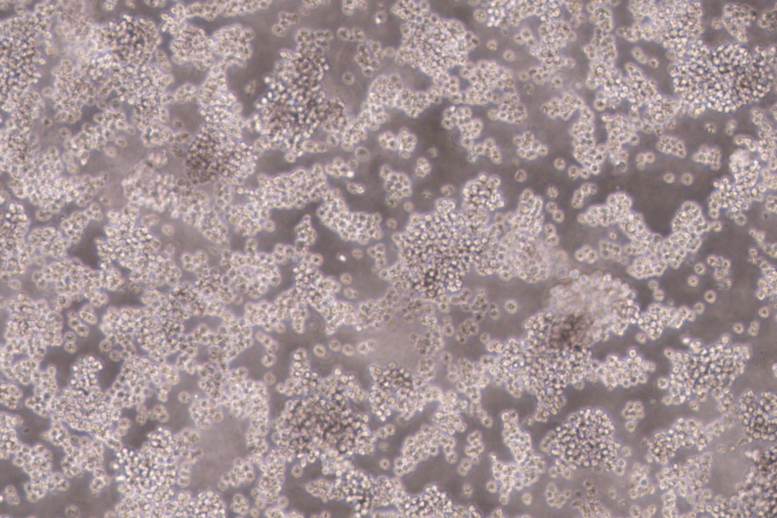 NB4 (人急性早幼粒细胞白血病细胞) (STR鉴定正确)