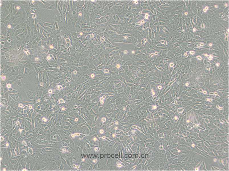 SW872 (人脂肪肉瘤细胞) (STR鉴定正确)