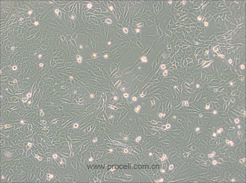 SW872 (人脂肪肉瘤细胞) (STR鉴定正确)