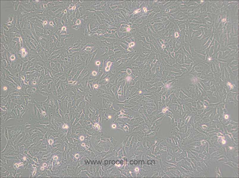 KHOS-240S (人骨肉瘤细胞) (STR鉴定正确)
