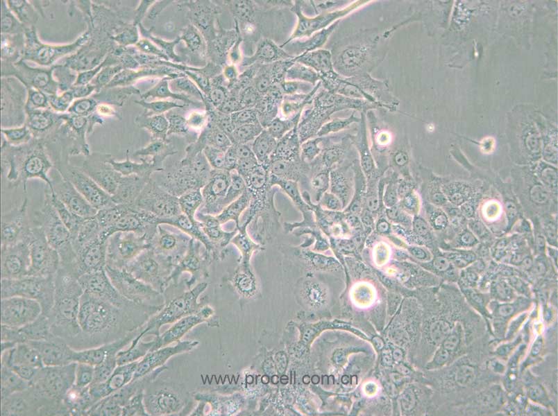 NCI-H1568 [H1568] (人非小细胞肺癌细胞) (STR鉴定正确)
