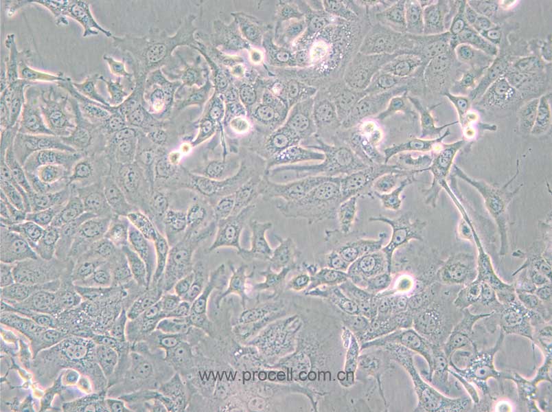 NCI-H1568 [H1568] (人非小细胞肺癌细胞) (STR鉴定正确)