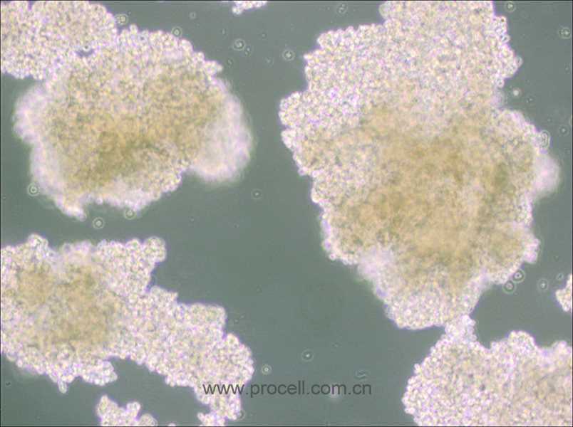 NCI-H146 [H146] (人小细胞肺癌细胞) (STR鉴定正确)