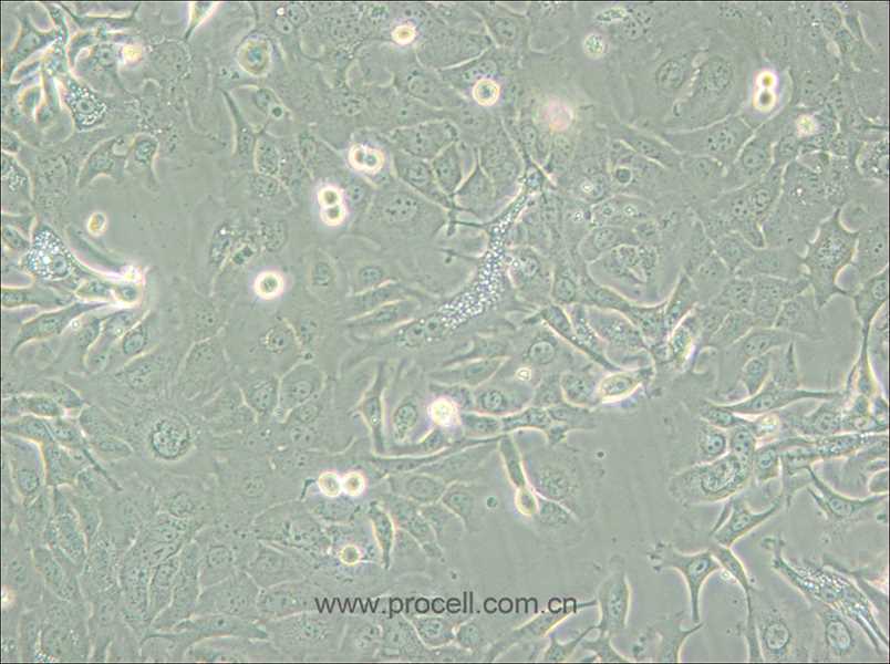 NCI-H146 [H146] (人小细胞肺癌细胞) (STR鉴定正确)