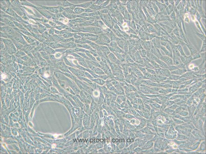 HT22 (小鼠海马神经元细胞) (STR鉴定正确)
