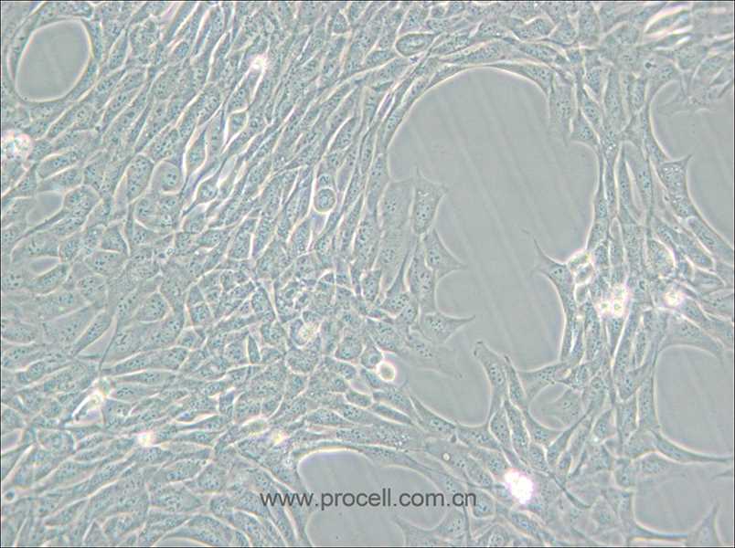 HT22 (小鼠海马神经元细胞) (STR鉴定正确)