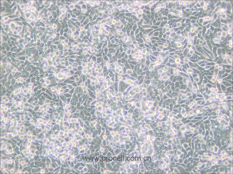 SW620/GFP (人结肠癌细胞(绿色荧光蛋白标记))  (STR鉴定正确)