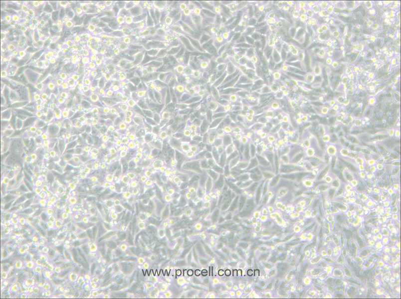 SW620/LUC (人结肠癌细胞(荧光素酶标记)) (DMEM) (STR鉴定正确)