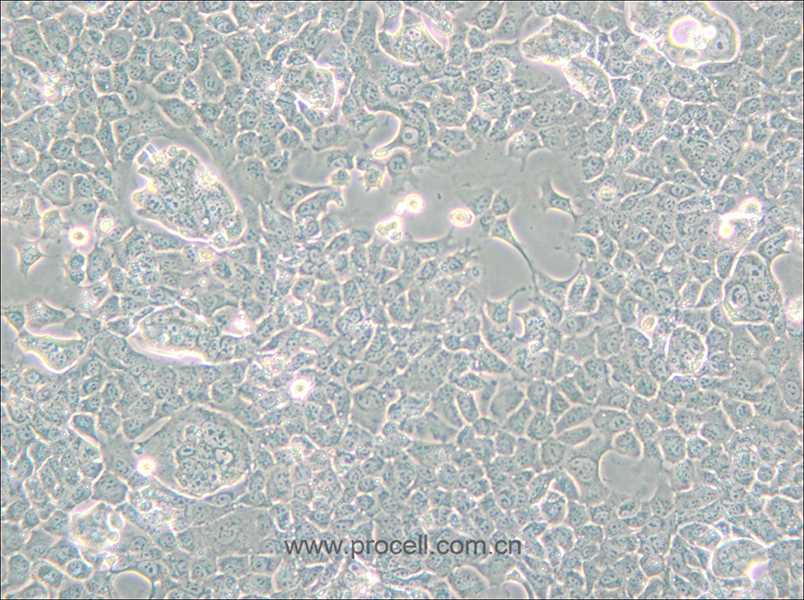 NCI-H508[H508] (人结肠直肠腺癌细胞) (STR鉴定正确)