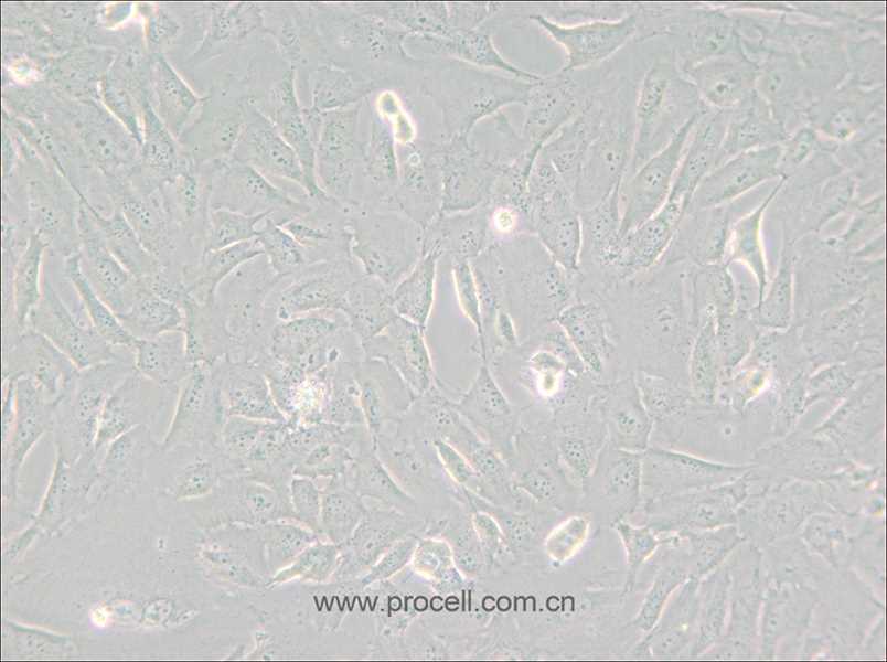 SJSA-1 (人骨肉瘤细胞) (STR鉴定正确)