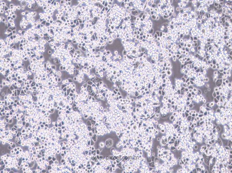 MDA-kb2 (人乳腺癌细胞)  (STR鉴定正确)