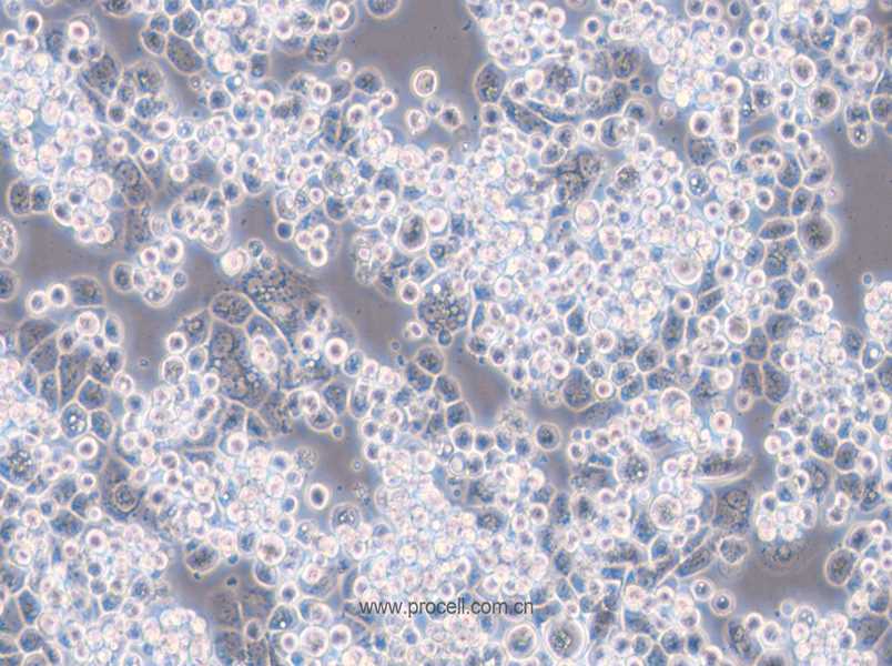 MDA-kb2 (人乳腺癌细胞)  (STR鉴定正确)