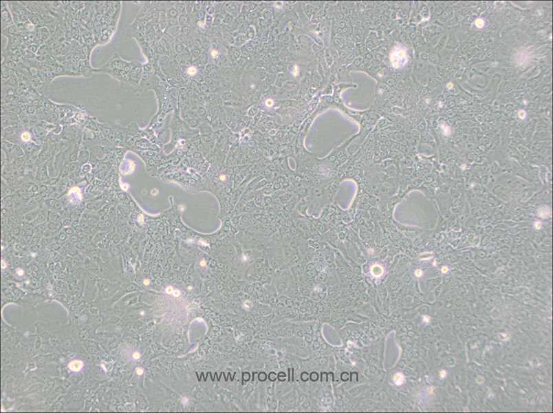 Capan-1（人胰腺癌细胞）（STR鉴定正确）