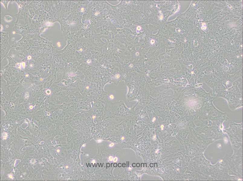 Capan-1 (人胰腺癌细胞) (STR鉴定正确)