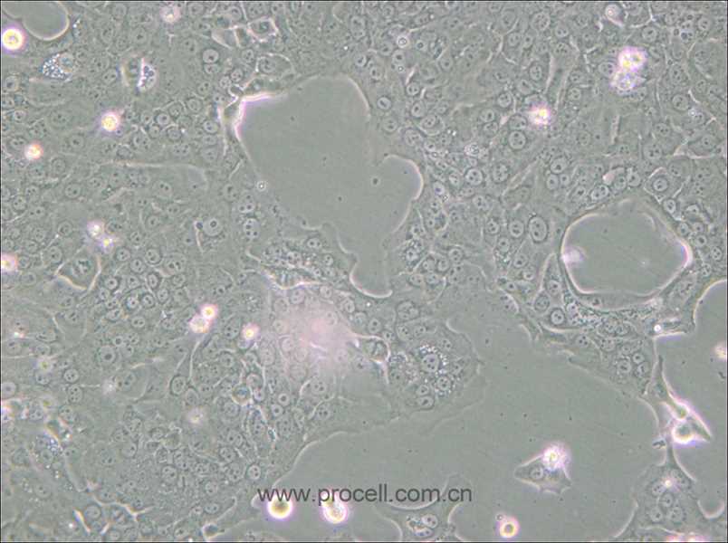 Capan-1 (人胰腺癌细胞) (STR鉴定正确)