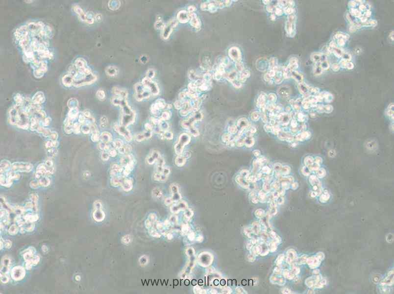 NCI-H82 [H82] (人小细胞肺癌细胞) (STR鉴定正确)