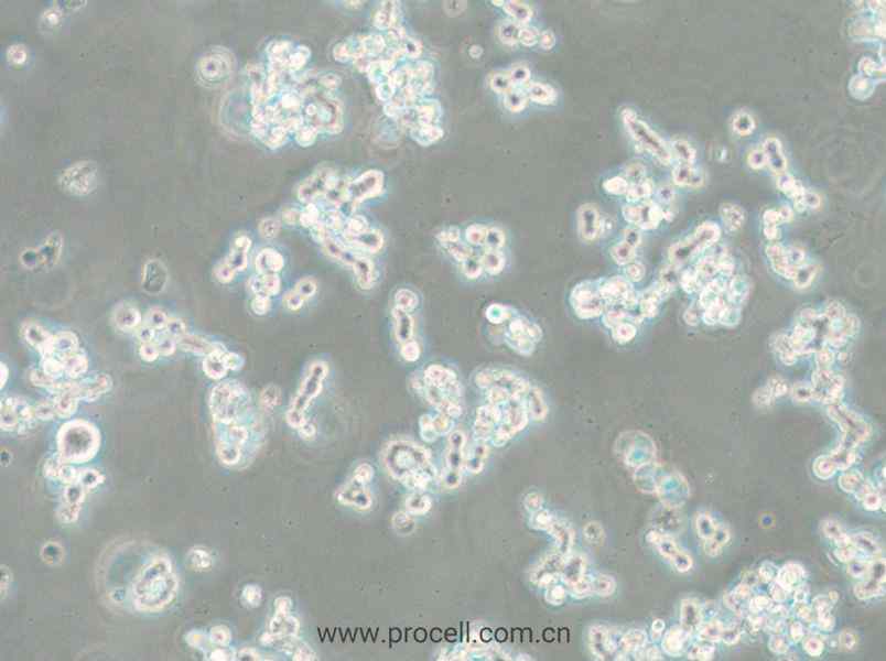 NCI-H82 [H82] (人小细胞肺癌细胞) (STR鉴定正确)