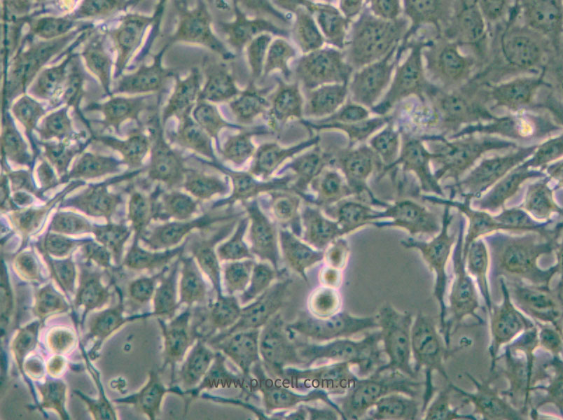 NCI-H3122 (人非小细胞肺癌细胞) (STR鉴定正确)