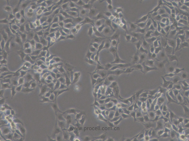 HCC1806 (人乳腺鳞状癌细胞) (STR鉴定正确)