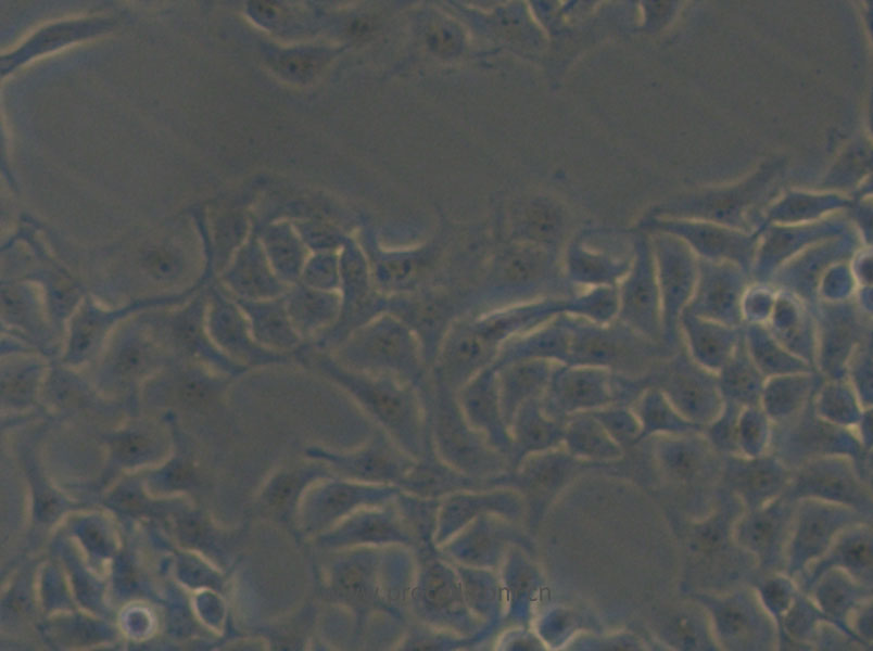 HCC1806 (人乳腺鳞状癌细胞) (STR鉴定正确)