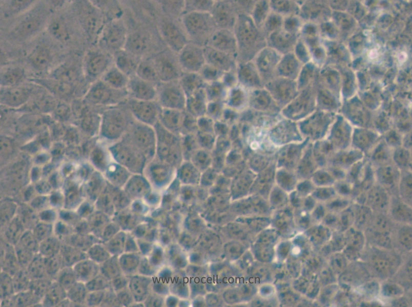 MKN74 (人胃癌细胞) (STR鉴定正确)