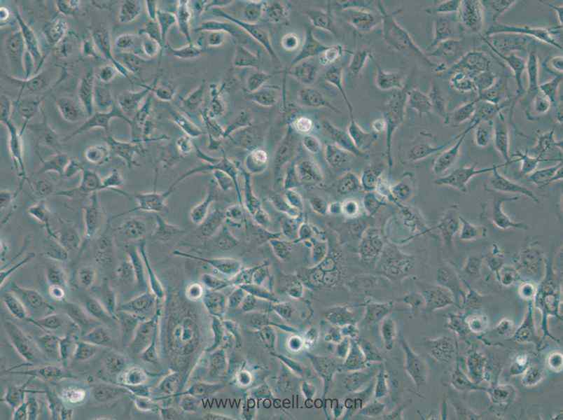 HBE135-E6E7 (人支气管上皮细胞) (STR鉴定正确)