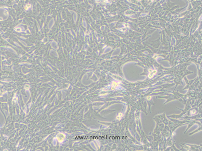 Panc02 (小鼠胰腺癌细胞) (STR鉴定正确)