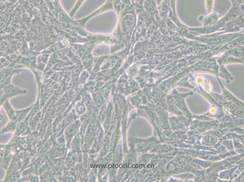 Panc02 (小鼠胰腺癌细胞) (STR鉴定正确)