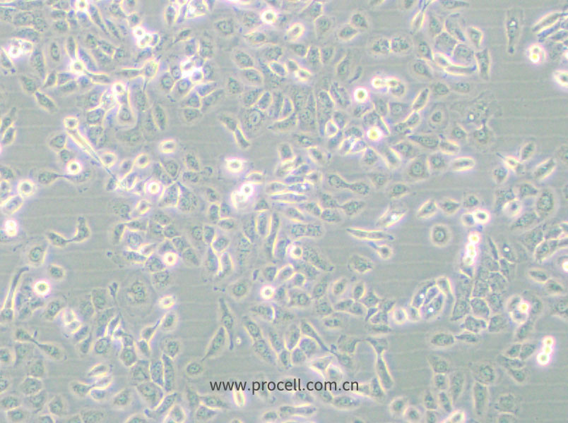 SUM149PT (人乳腺癌细胞) (STR鉴定正确)