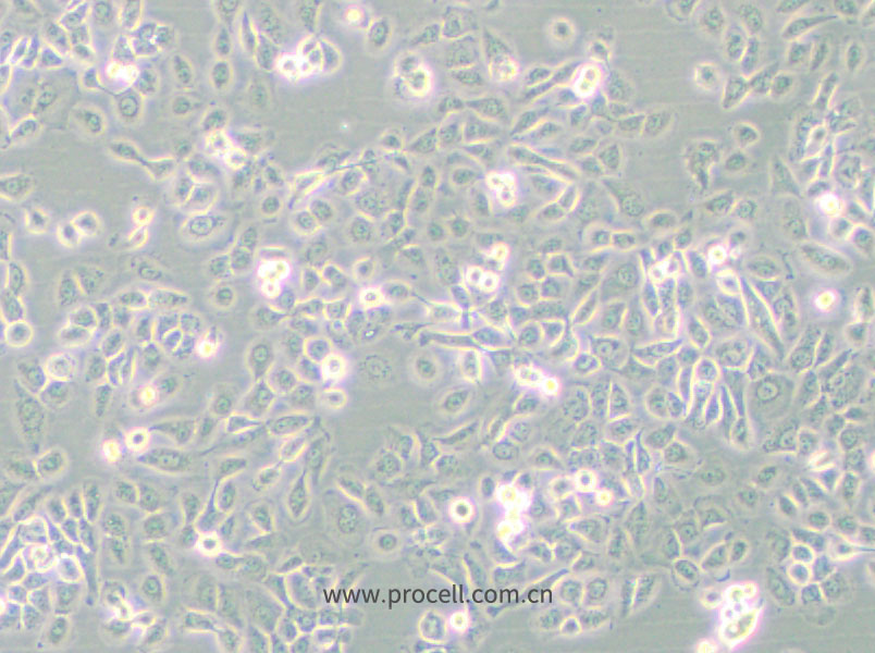SUM149PT (人乳腺癌细胞) (STR鉴定正确)