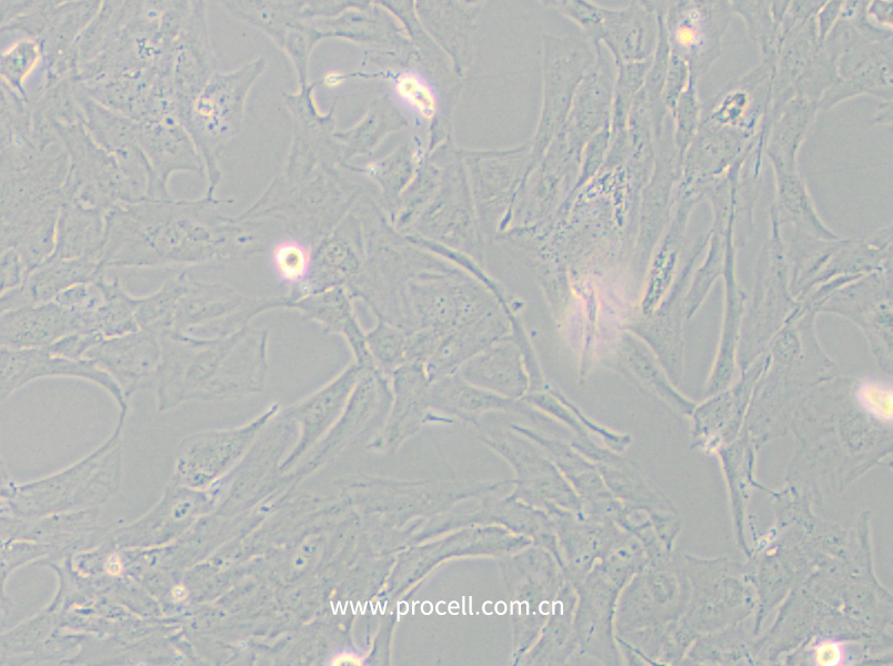 NCI-H196 (人小细胞肺癌细胞) (STR鉴定正确)
