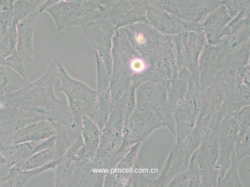 NCI-H196 (人小细胞肺癌细胞) (STR鉴定正确)