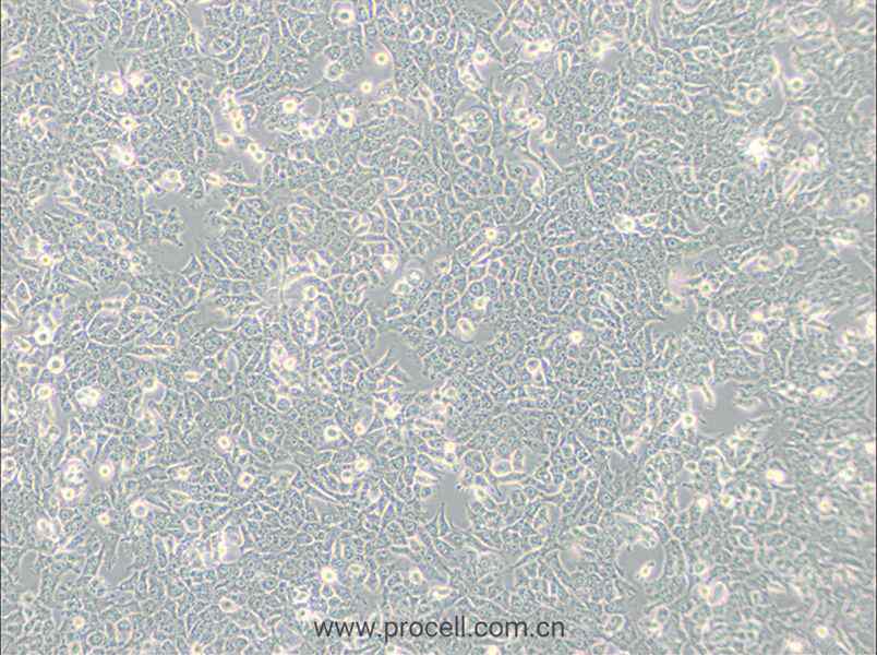 SN12C (人肾癌细胞) (STR鉴定正确)