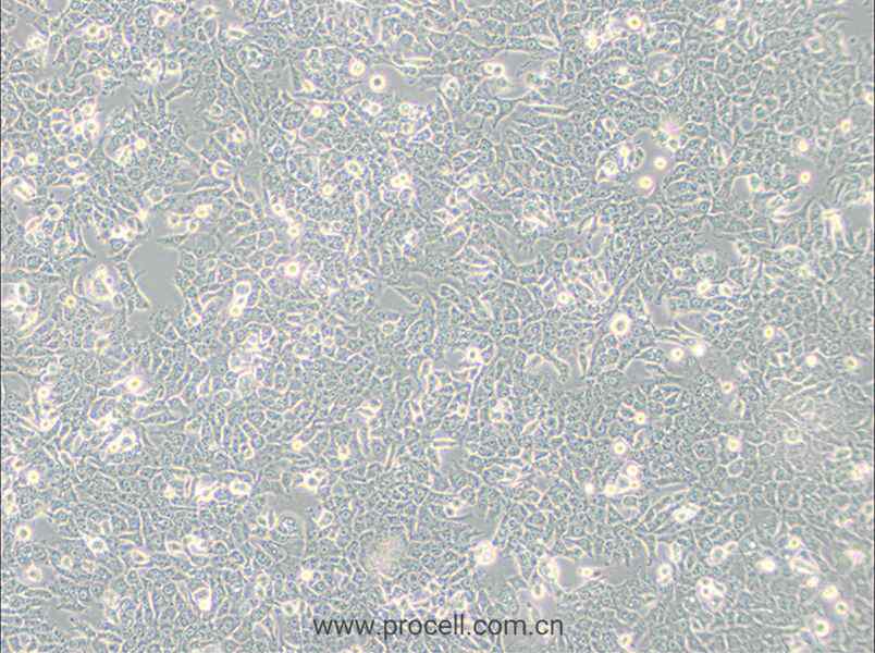 SN12C (人肾癌细胞) (STR鉴定正确)