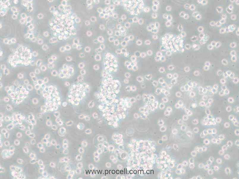 SU-DHL-6 (人弥散性组织淋巴瘤细胞) (STR鉴定正确)