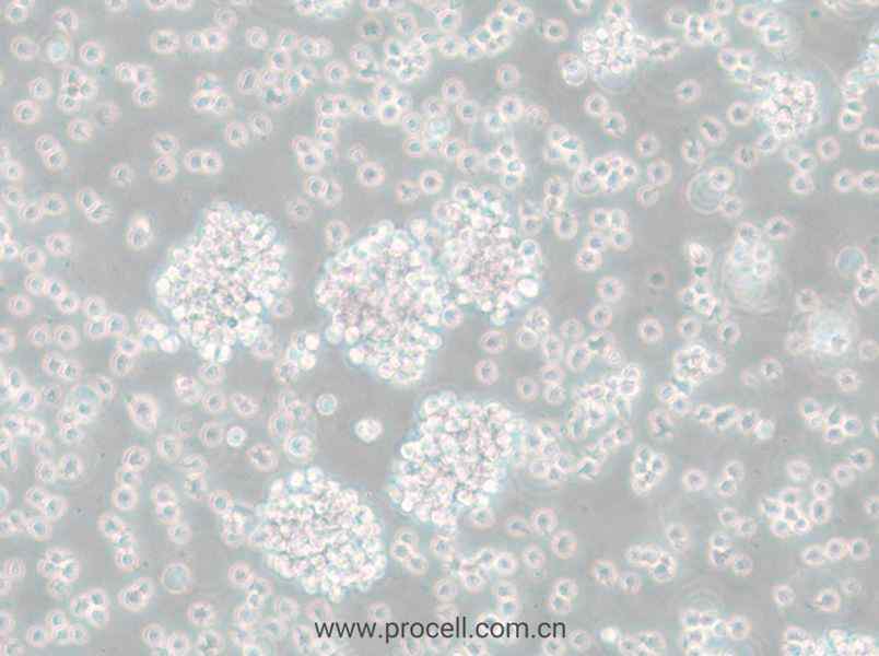 SU-DHL-6 (人弥散性组织淋巴瘤细胞) (STR鉴定正确)