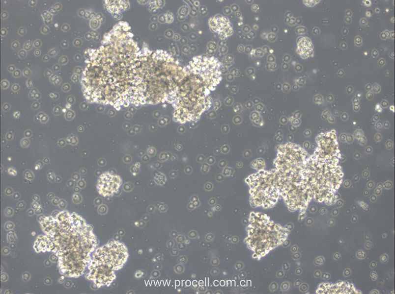 OCI-Ly3 (人弥漫大 B 细胞淋巴瘤细胞) (STR鉴定正确)