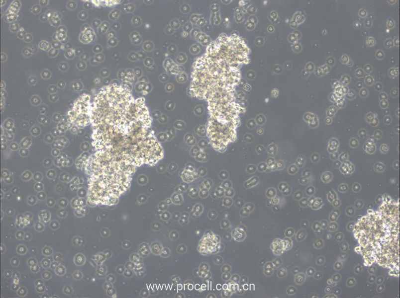 OCI-Ly3 (人弥漫大 B 细胞淋巴瘤细胞) (STR鉴定正确)