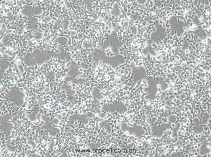 HKb20 (人肾上皮细胞) (STR鉴定正确)